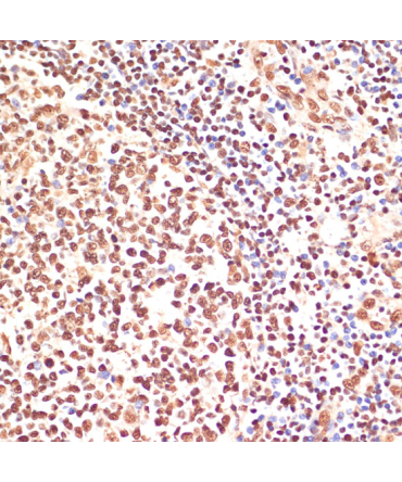 PARP1 Rabbit Polyclonal Antibody