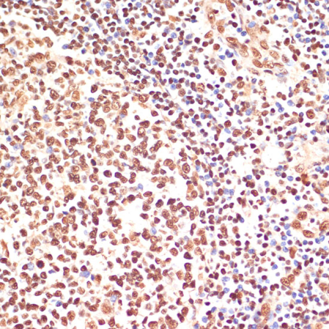 PARP1 Rabbit Polyclonal Antibody
