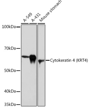 Cytokeratin 4 (KRT4) Rabbit Monoclonal Antibody