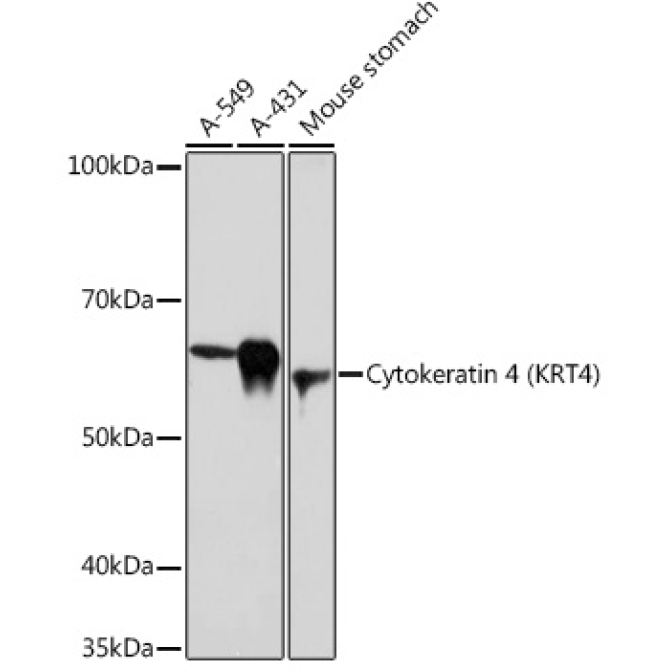 Cytokeratin 4 (KRT4) Rabbit Monoclonal Antibody