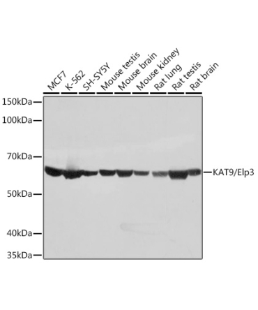 KAT9/Elp3 Rabbit Monoclonal Antibody