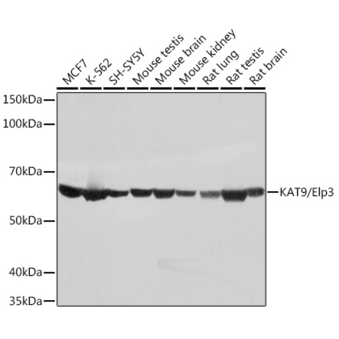 KAT9/Elp3 Rabbit Monoclonal Antibody