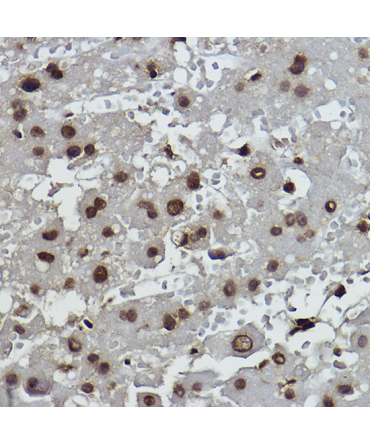 Formyl-Histone H2B-K19,400 Rabbit Monoclonal Antibody