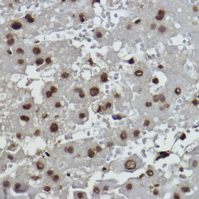 Formyl-Histone H2B-K19,400 Rabbit Monoclonal Antibody