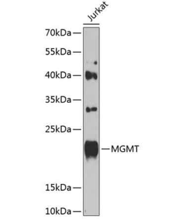 MGMT Rabbit Polyclonal Antibody