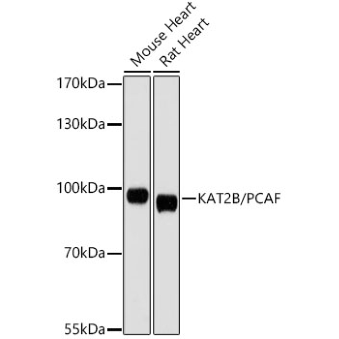 KAT2B/PCAF Rabbit Polyclonal Antibody