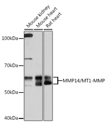 MMP14/MT1-MMP Rabbit Monoclonal Antibody