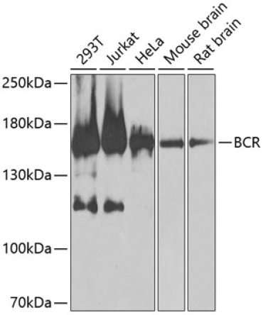 BCR Rabbit Polyclonal Antibody