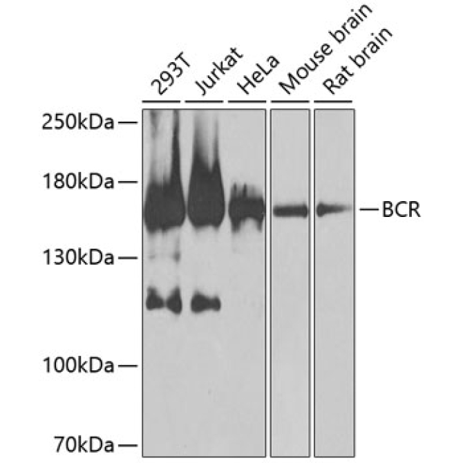 BCR Rabbit Polyclonal Antibody