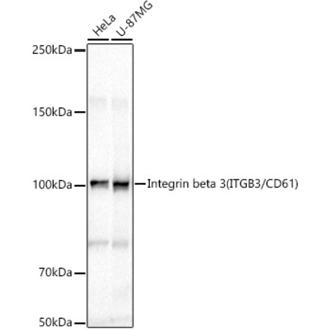 Integrin beta 3 (ITGB3/CD61) Rabbit Polyclonal Antibody