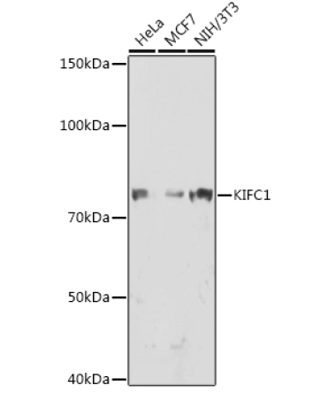 KIFC1 Rabbit Monoclonal Antibody