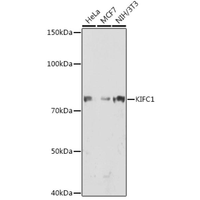 KIFC1 Rabbit Monoclonal Antibody