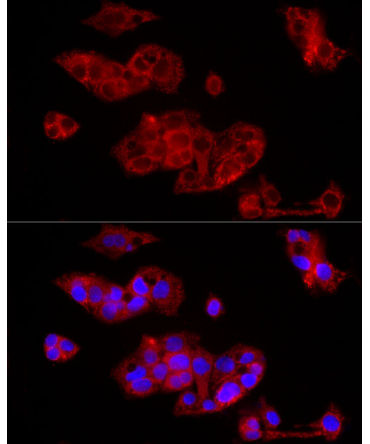 FGF1 Rabbit Polyclonal Antibody