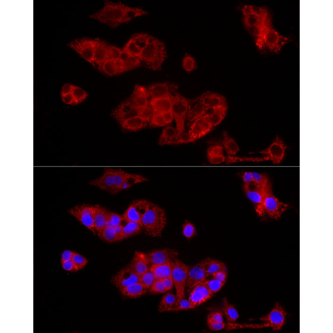 FGF1 Rabbit Polyclonal Antibody