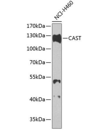 CAST Rabbit Polyclonal Antibody
