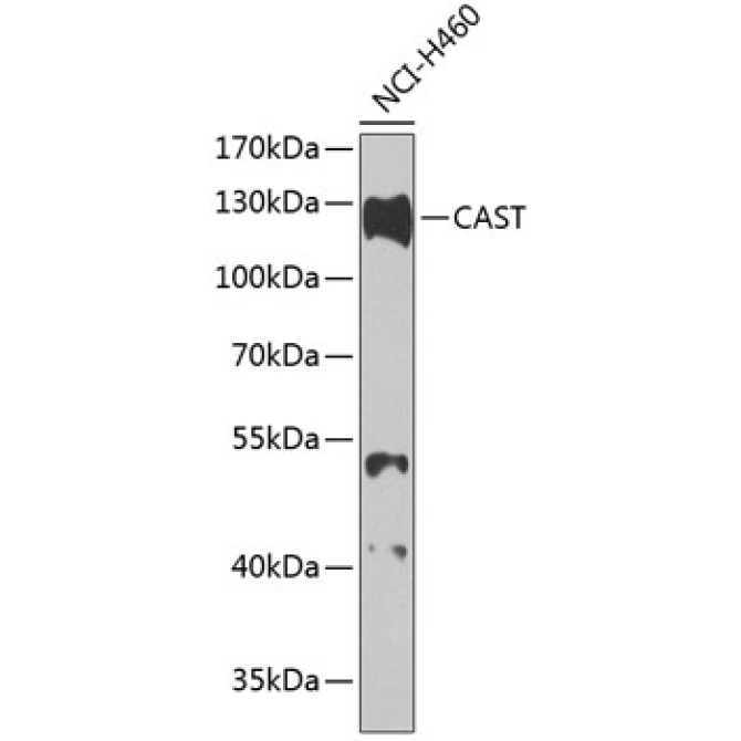 CAST Rabbit Polyclonal Antibody