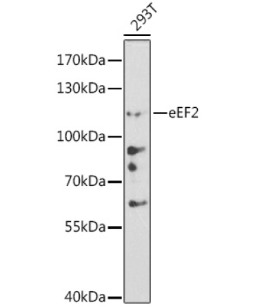 eEF2 Rabbit Polyclonal Antibody