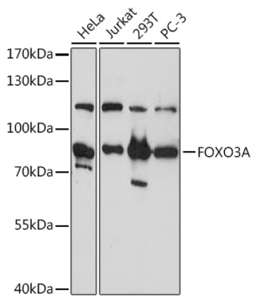FOXO3A Rabbit Polyclonal Antibody