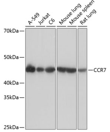 CCR7 Rabbit Monoclonal Antibody