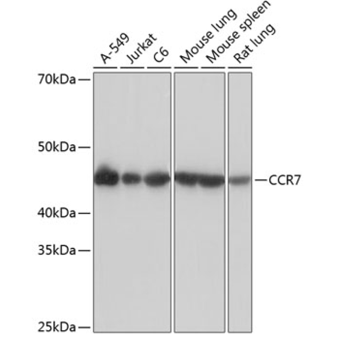 CCR7 Rabbit Monoclonal Antibody