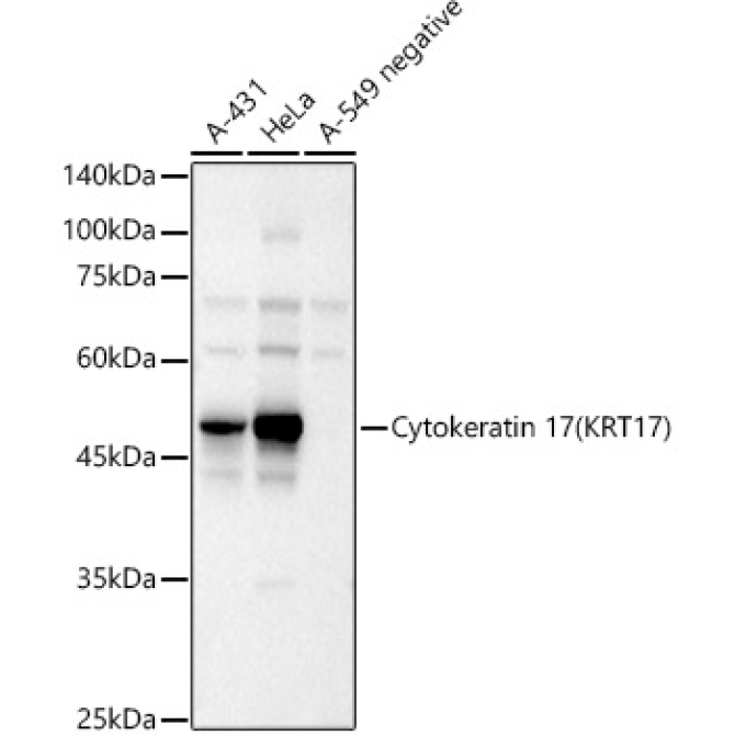 Cytokeratin 17 (KRT17) Rabbit Polyclonal Antibody