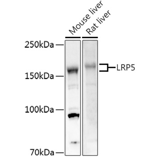 LRP5 Rabbit Polyclonal Antibody