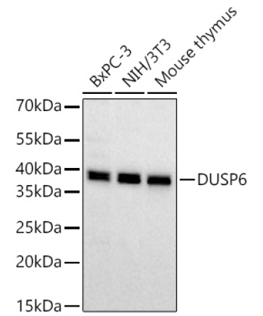 DUSP6 Rabbit Monoclonal Antibody