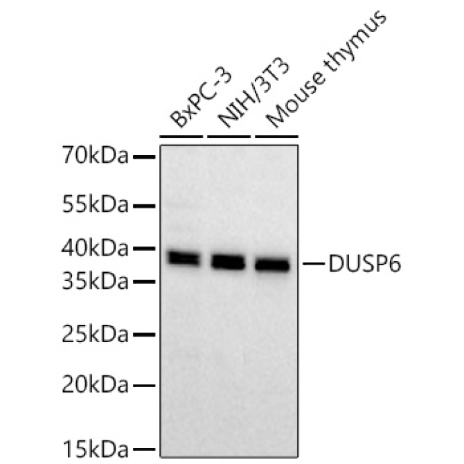 DUSP6 Rabbit Monoclonal Antibody