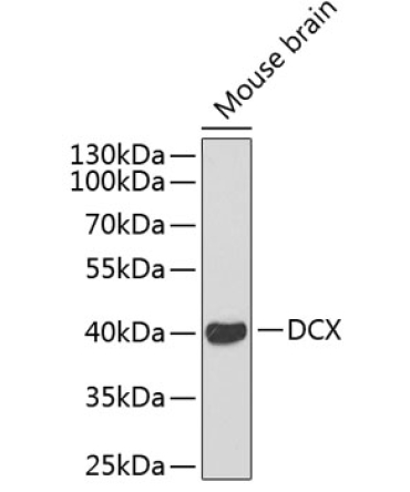 Doublecortin Rabbit Polyclonal Antibody