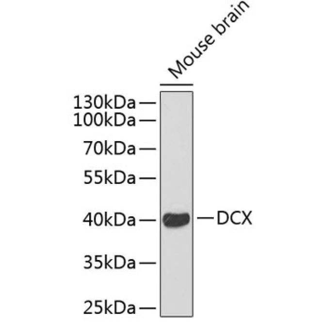 Doublecortin Rabbit Polyclonal Antibody