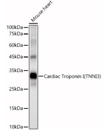 Cardiac Troponin I (TNNI3) Rabbit Polyclonal Antibody