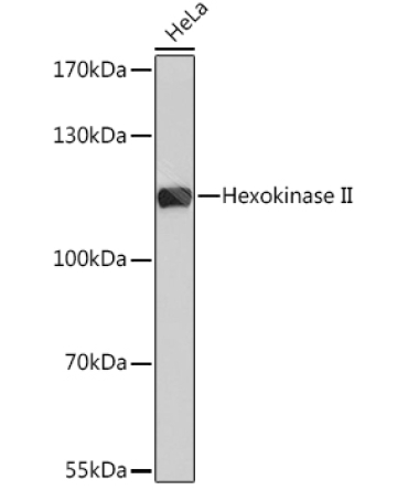 Hexokinase II Rabbit Polyclonal Antibody