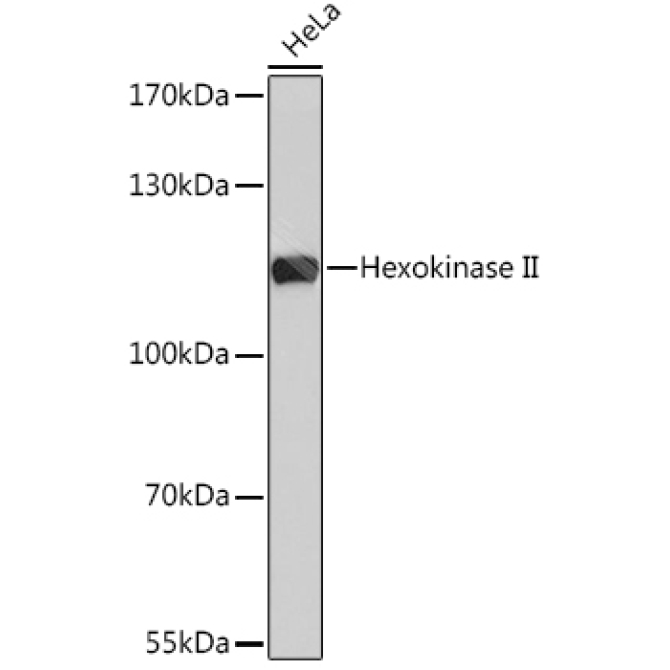 Hexokinase II Rabbit Polyclonal Antibody
