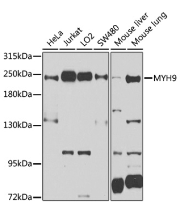 MYH9 Rabbit Polyclonal Antibody