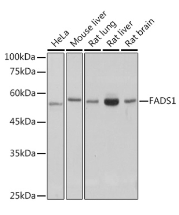 FADS1 Rabbit Monoclonal Antibody