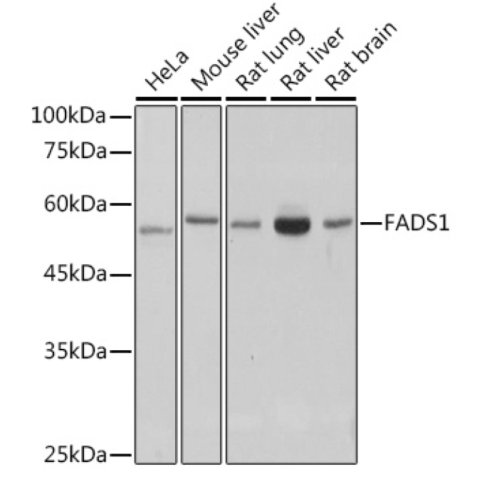 FADS1 Rabbit Monoclonal Antibody