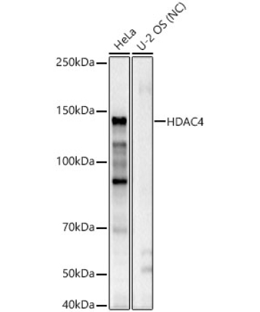 HDAC4 Rabbit Polyclonal Antibody