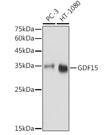 GDF15 Rabbit Polyclonal Antibody