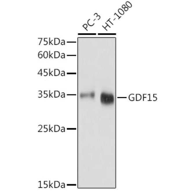 GDF15 Rabbit Polyclonal Antibody