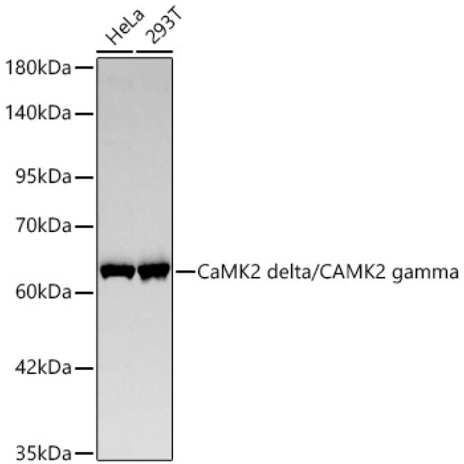CaMK2 delta/CAMK2 gamma Rabbit Monoclonal Antibody