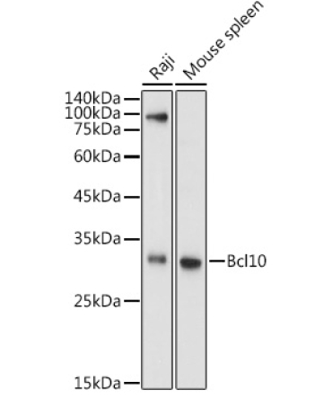 Bcl10 Rabbit Polyclonal Antibody