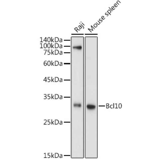 Bcl10 Rabbit Polyclonal Antibody