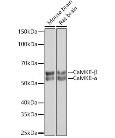 CaMKII Rabbit Monoclonal Antibody