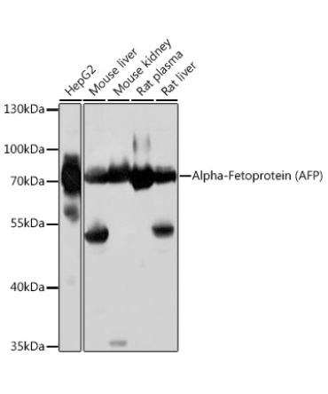 Alpha-Fetoprotein (AFP) Rabbit Polyclonal Antibody