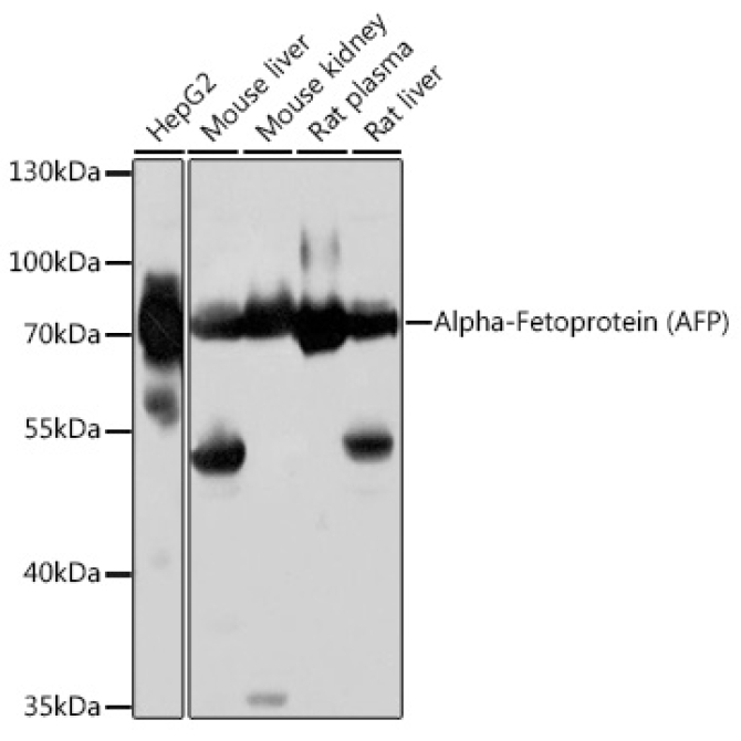 Alpha-Fetoprotein (AFP) Rabbit Polyclonal Antibody