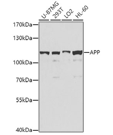 APP Rabbit Polyclonal Antibody