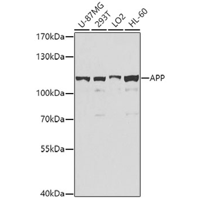 APP Rabbit Polyclonal Antibody