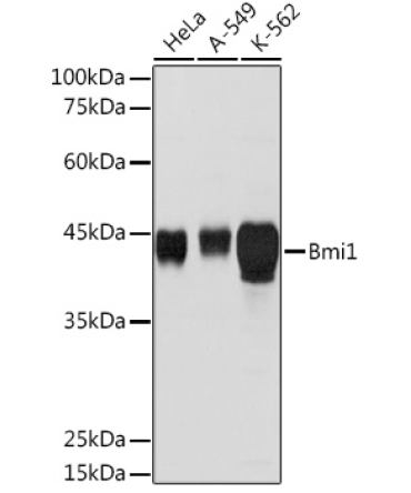 Bmi1 Rabbit Polyclonal Antibody