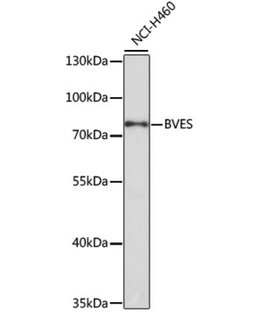 BVES Rabbit Polyclonal Antibody