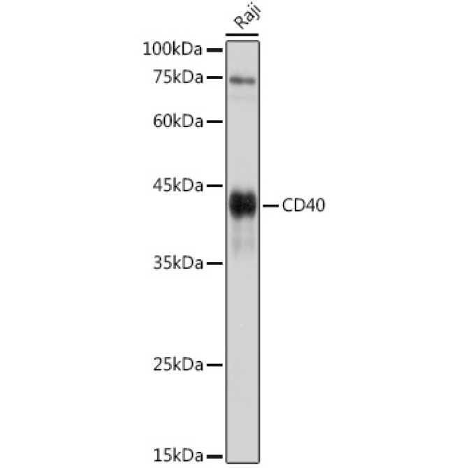 CD40 Rabbit Polyclonal Antibody